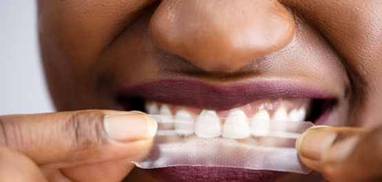 Closeup of someone placing whitening strip over upper arch of teeth