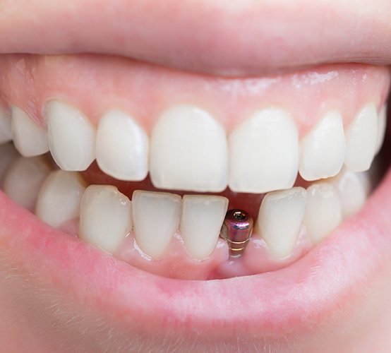 Man smiling at dentist in Owasso